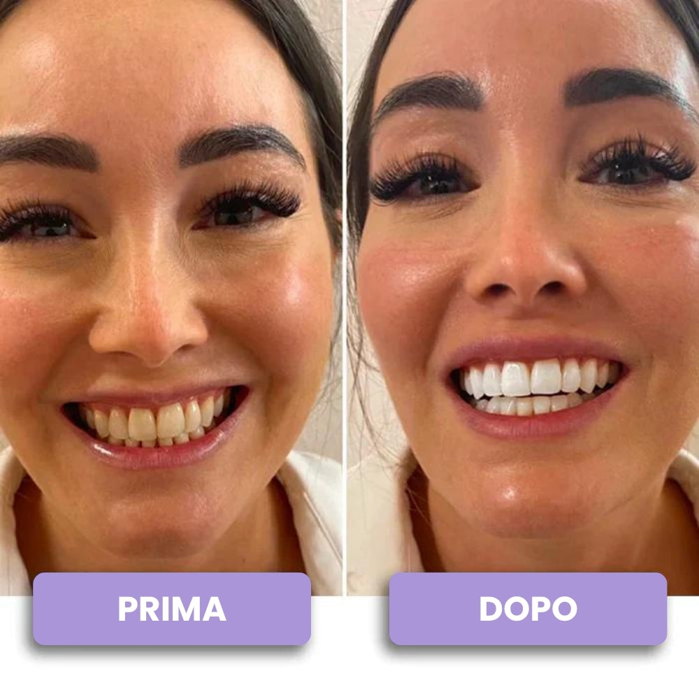 Pulitore Dentale a Ultrasuoni per Placca e Residui, Pulizia Profonda a Casa