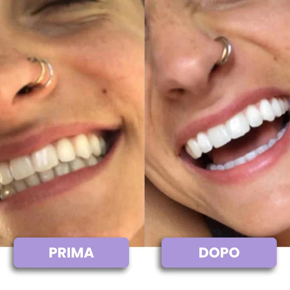 Pulitore Dentale a Ultrasuoni per Placca e Residui, Pulizia Profonda a Casa